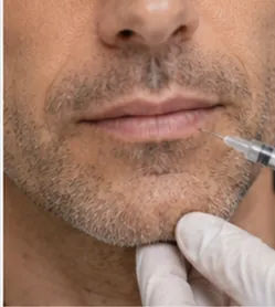 Lábios Masculinos Naturais — quadro ilustrativo de soluções