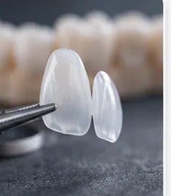Lente Dental de Porcelana — quadro ilustrativo de soluções