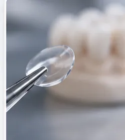 Lente de Contato Dental — quadro ilustrativo de soluções