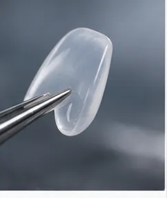 Lente Dental Ultrafina — quadro ilustrativo de soluções