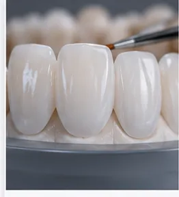 Faceta de Porcelana Premium — quadro ilustrativo de soluções